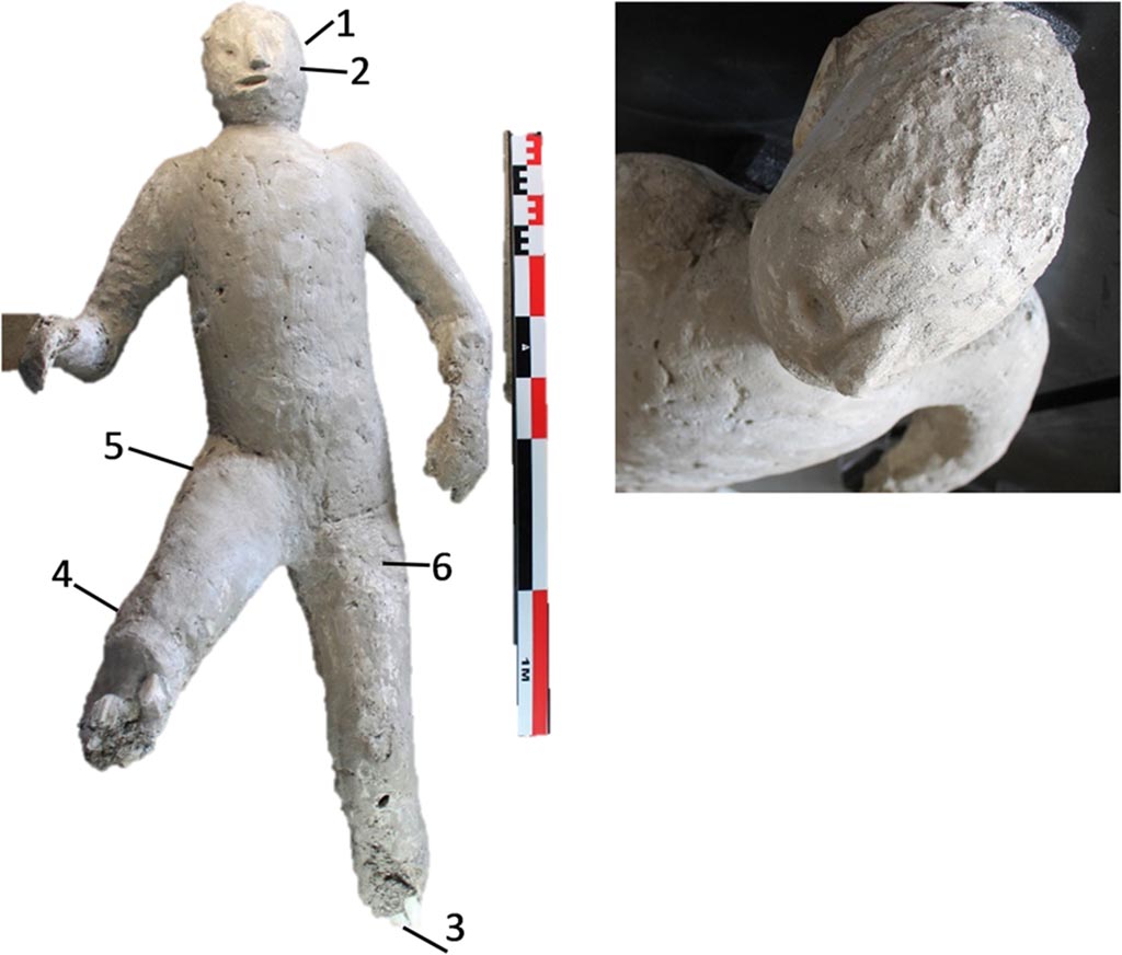Victim 59. Cast, numbered as #64 in the casts of Pompeii Project, and pXRF measuring points (1–6).
The cast #64 is a male adult individual between 45 and 50 years old, very altered and remodelled in an old restoration, especially in the zygomatic-facial area. This individual was originally found supine, with the upper extremities separated from the body.
Cast #64 presents osteoarthritis in the right knee and in the medial condyle of left femur.
Photo courtesy of The Casts of Pompeii Project. Use subject to CC BY 4.0 Deed 
See Alapont L, Gallello G, Martinón-Torres M, Osanna M, Amoretti V, Chenery S, et al. (2023) The casts of Pompeii: Post-depositional methodological insights. PLoS ONE 18(8): e0289378, fig. 5. https://doi.org/10.1371/journal.pone.0289378 
This photo seems to correspond with those in the catalogue for victim 59.
See Osanna, N., Capurso, A., e Masseroli, S. M., 2021. I Calchi di Pompei da Giuseppe Fiorelli ad oggi: Studi e Ricerche del PAP 46, p. 459-460, Calco n. 59.

