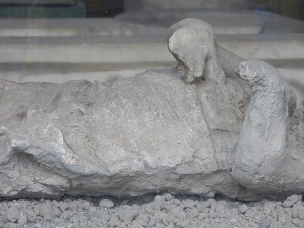 VII.7.29 Pompeii. May 2015. Detail from plaster cast of body of child found in VI.17.42.
Photo courtesy of Buzz Ferebee.

