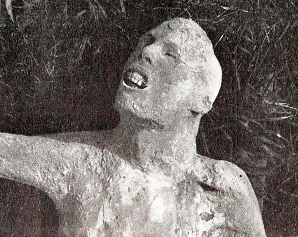 Cast of body (no. 4?) found outside Porta Nola near tomb of Obellius Firmus. According to De Caro, the face shows the dramatic image of the pangs of death.
See De Caro S., 1979. Scavi nell’area fuori Porta Nola a Pompei: Cronache Pompeiane V, (fig. 26). 
